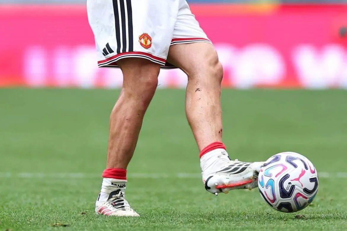 Góc Nhìn EX88: TA bàn vì sao cầu thủ Premier League thích tấm bảo vệ ống chân nhỏ: Thoải mái và t